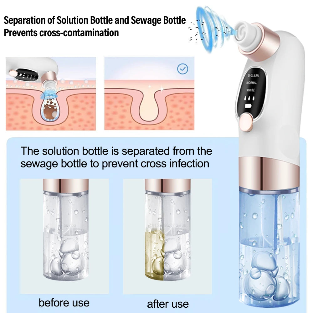 Pore Clean Vacuum