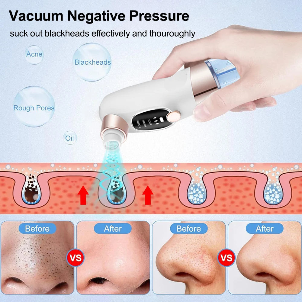 Pore Clean Vacuum
