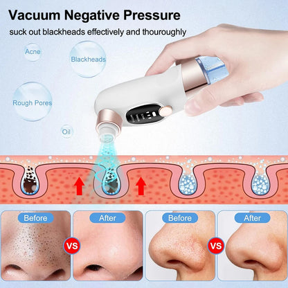 Pore Clean Vacuum