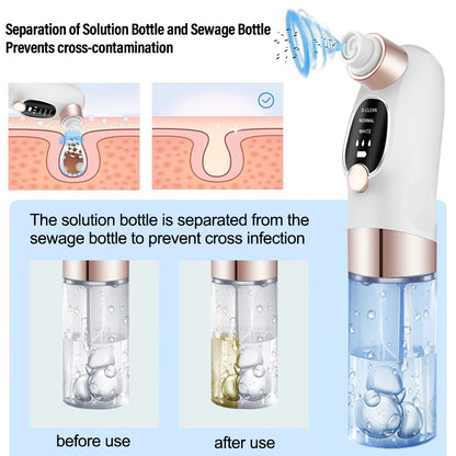Pore Clean Vacuum
