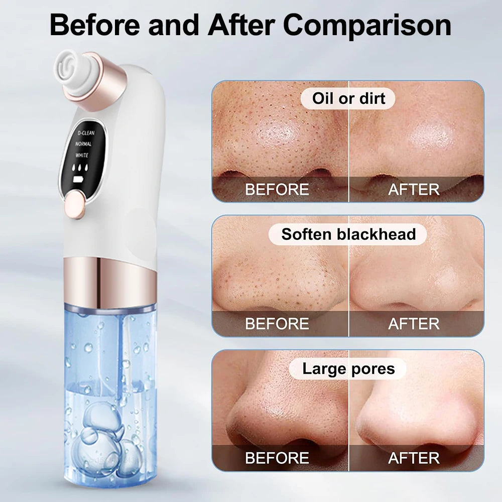 Pore Clean Vacuum